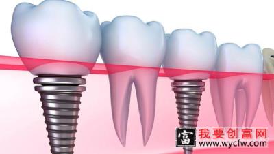 科普动画：最科学的牙齿种植操作流程