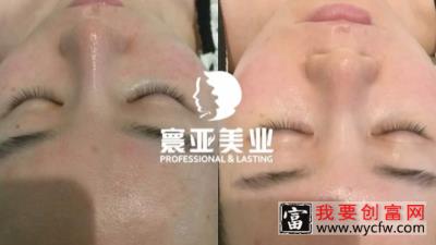 细胞种植技术，高端无创中胚管理项目来了